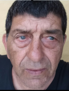 OCAÑA LUIS ALFONSO<b>(I)</b>
